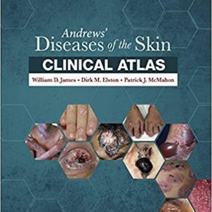 Andrews' Diseases of the Skin Clinical Atlas: Expert Consult Har/Psc Edition - eBooks