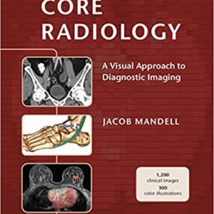 Core Radiology: A Visual Approach to Diagnostic Imaging (1st Edition) - eBooks