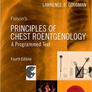 Felson's Principles of Chest Roentgenology (4th Edition) - eBook