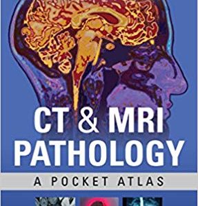 CT & MRI Pathology: A Pocket Atlas (3rd Edition) - eBook
