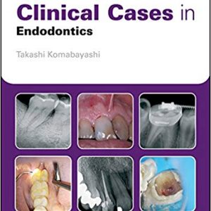 Clinical Cases in Endodontics - eBook