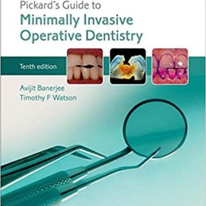 Pickard's Guide to Minimally Invasive Operative Dentistry (10th Edition) - eBook