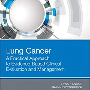 Lung Cancer: A Practical Approach to Evidence-Based Clinical Evaluation and Management - eBook