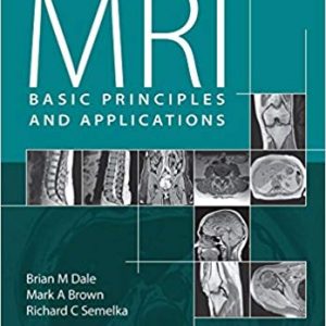 MRI: Basic Principles and Applications (5th Edition) - eBook