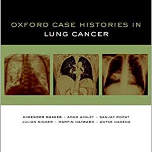 Oxford Case Histories in Lung Cancer - eBook