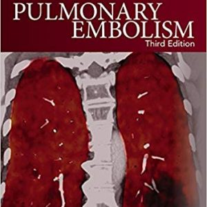 Pulmonary Embolism (3rd Edition) - eBook