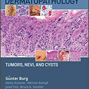 Atlas of Dermatopathology: Tumors, Nevi, and Cysts - eBook
