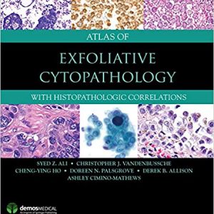 Atlas of Exfoliative Cytopathology: With Histopathologic Correlations - eBook
