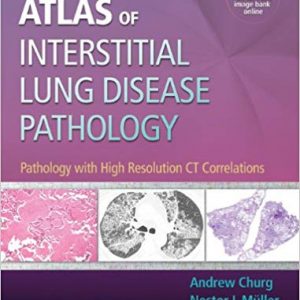 Atlas of Interstitial Lung Disease Pathology: Pathology with High Resolution CT Correlations - eBook
