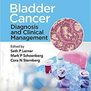 Bladder Cancer: Diagnosis and Clinical Management - eBook
