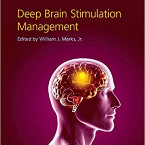 Deep Brain Stimulation Management (2nd Edition) - eBook