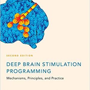 Deep Brain Stimulation Programming: Mechanisms, Principles and Practice (2nd Edition) - eBook