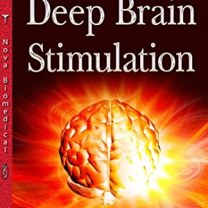 Deep Brain Stimulation - eBook