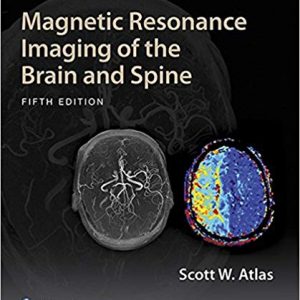 Magnetic Resonance Imaging of the Brain and Spine (5th Edition) - eBook
