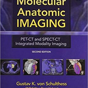 Molecular Anatomic Imaging: PET-CT and SPECT-CT Integrated Modality Imaging (2nd Edition) - eBook