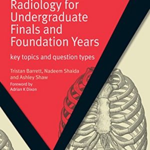 Radiology for Undergraduate Finals and Foundation Years: Key Topics and Question Types (MasterPass) - eBook