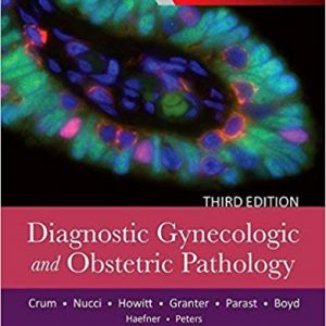 Diagnostic Gynecologic and Obstetric Pathology (3rd Edition) - eBook