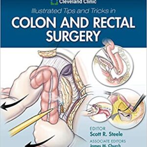 Cleveland Clinic Illustrated Tips and Tricks in Colon and Rectal Surgery - eBook