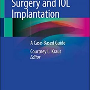 Pediatric Cataract Surgery and IOL Implantation: A Case-Based Guide - eBook