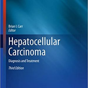 Hepatocellular Carcinoma - Diagnosis and Treatment (3rd Edition) - PDF