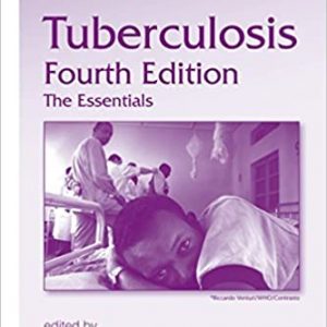 Tuberculosis: The Essentials (4th Edition)- eBook