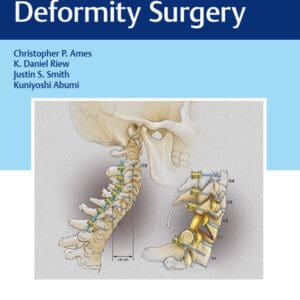 Cervical Spine Deformity Surgery - eBook