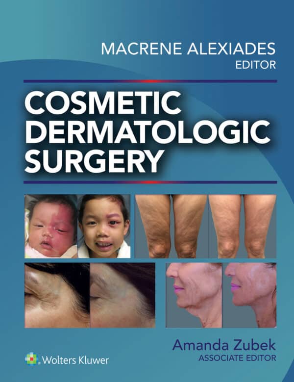 Cosmetic Dermatologic Surgery - eBook