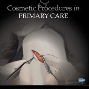 Dermatologic Surgery and Cosmetic Procedures in Primary Care Practice - eBook