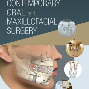 Contemporary Oral and Maxillofacial Surgery (7th Edition) - eBook