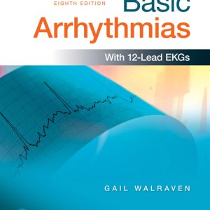 Basic Arrhythmias (8th Edition) - eBook