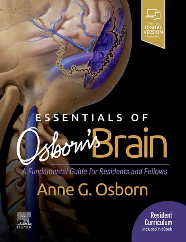 Essentials-of-Osborns-Brain-pdf